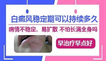 治疗皮肤白斑医院